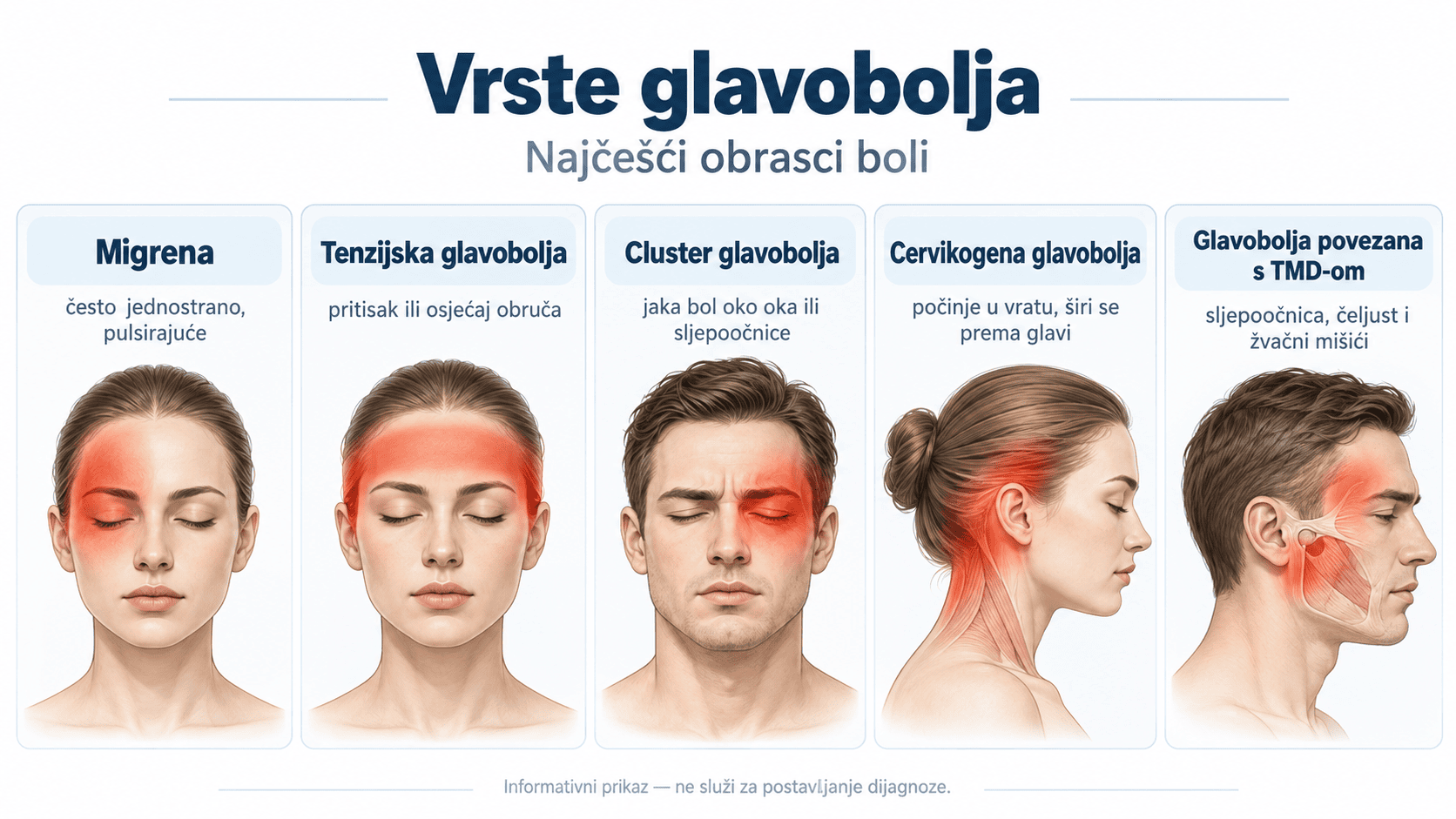 Pregled najčešćih vrsta glavobolje i njihovih obrazaca boli: migrena, tenzijska, cluster, cervikogena i glavobolja povezana s TMD-om